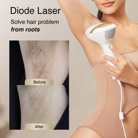 DermRays Laser Hair Removal Device V4S close-up of nozzle