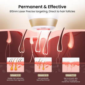 DermRays Laser Hair Removal Device V4S packaging