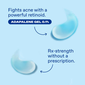 Differin Acne Gel application on skin