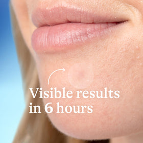 Differin Acne Pimple Patches ingredients list