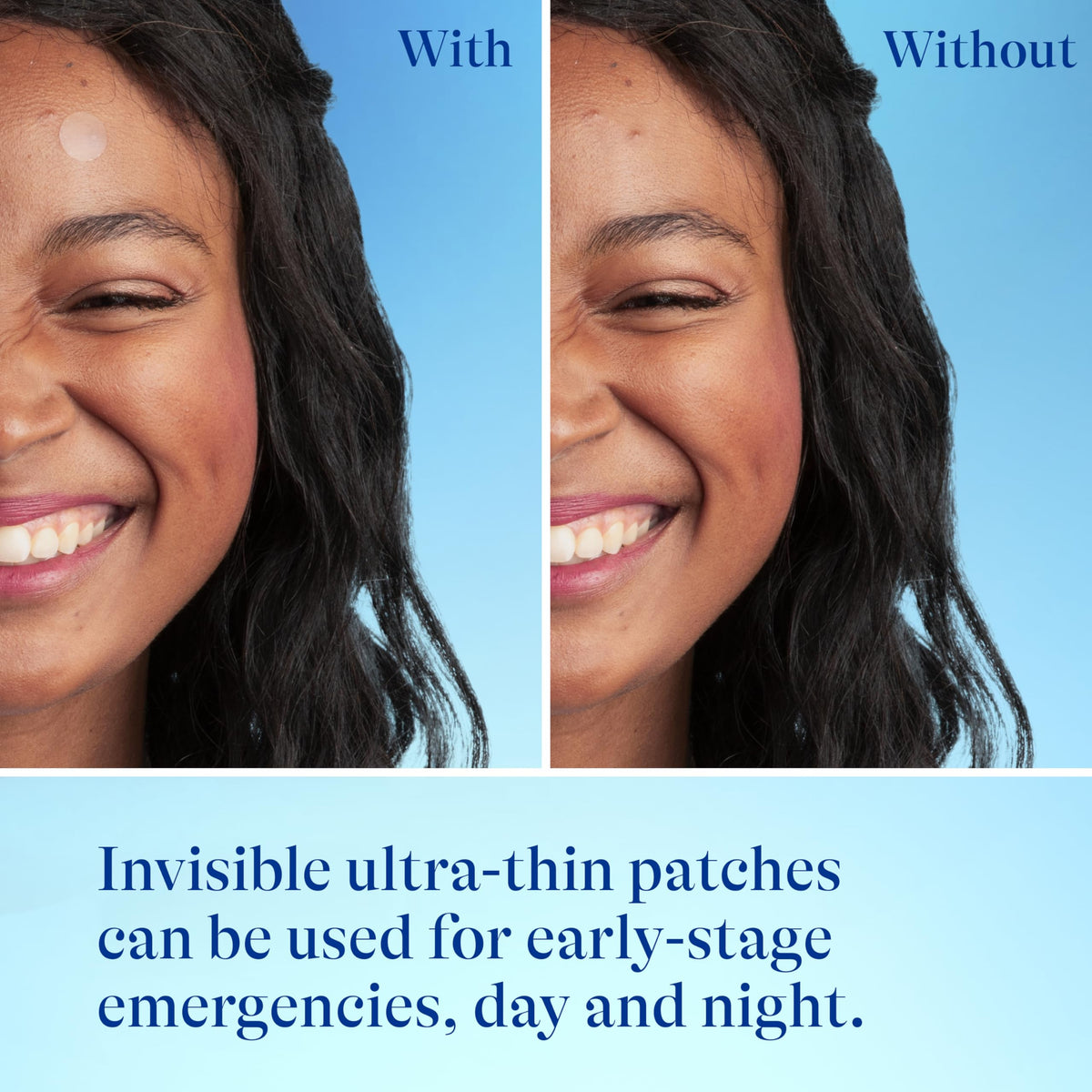 Differin Acne Pimple Patches side view showing packaging