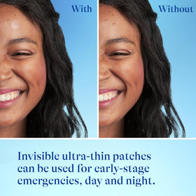 Differin Acne Pimple Patches side view showing packaging