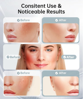 Dopsikn facial massager displaying 7 colour light therapy