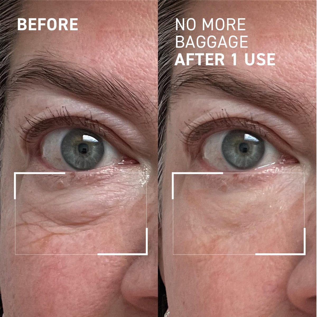 Dr. Brandt Needles No More Baggage Eye Gel texture close-up
