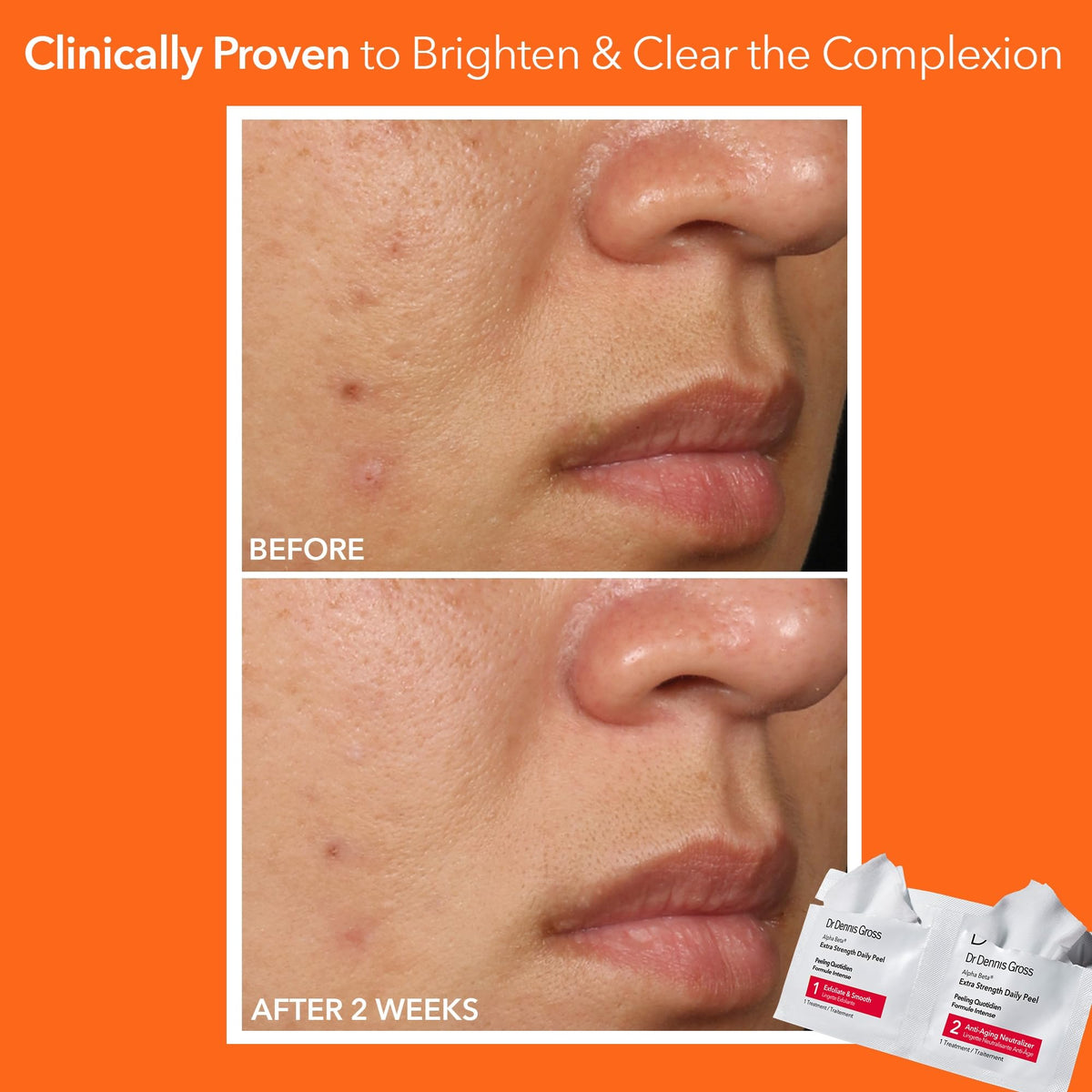 Dr Dennis Gross Alpha Beta Extra Strength Daily Peel application on skin
