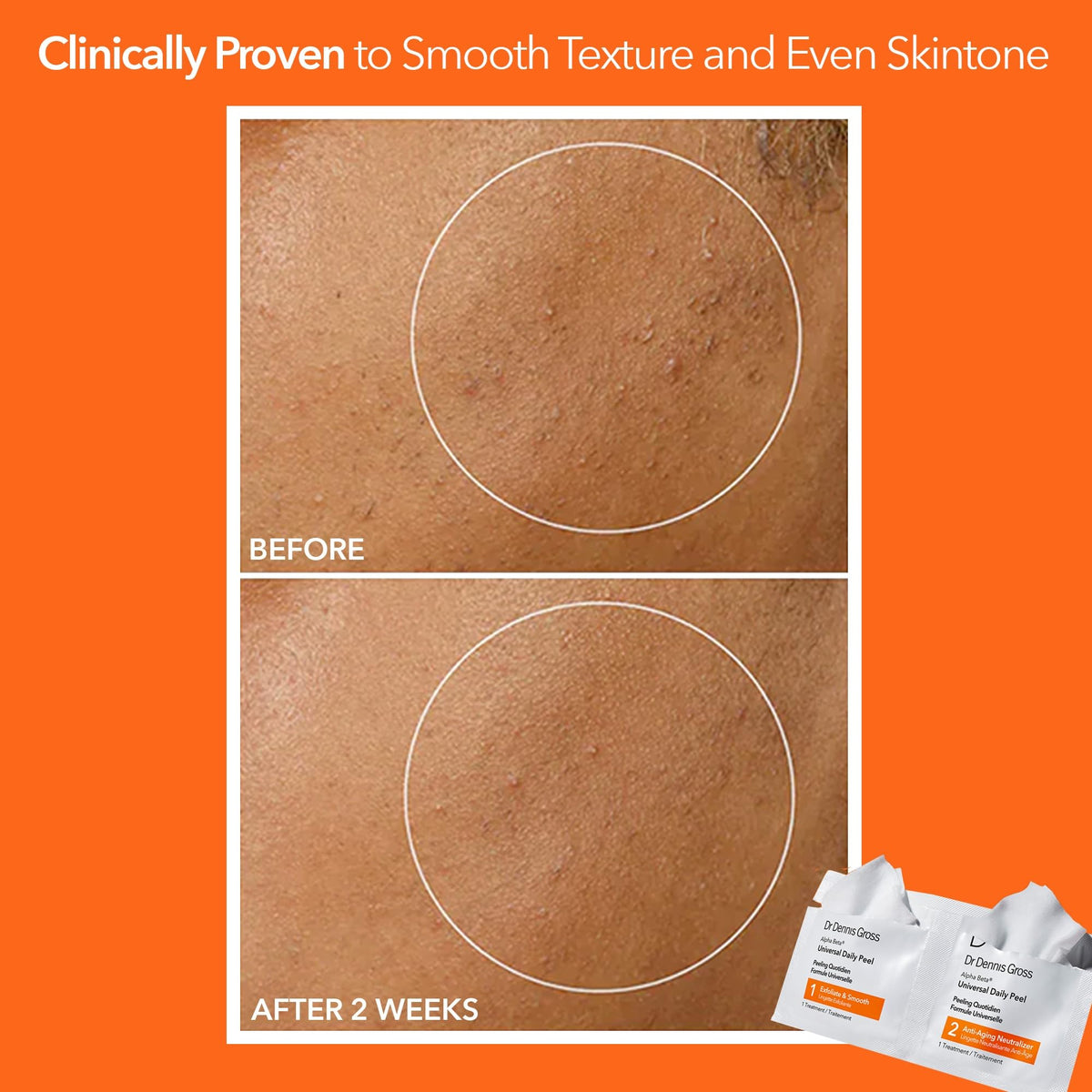 Dr Dennis Gross Alpha Beta Universal Daily Peel pads