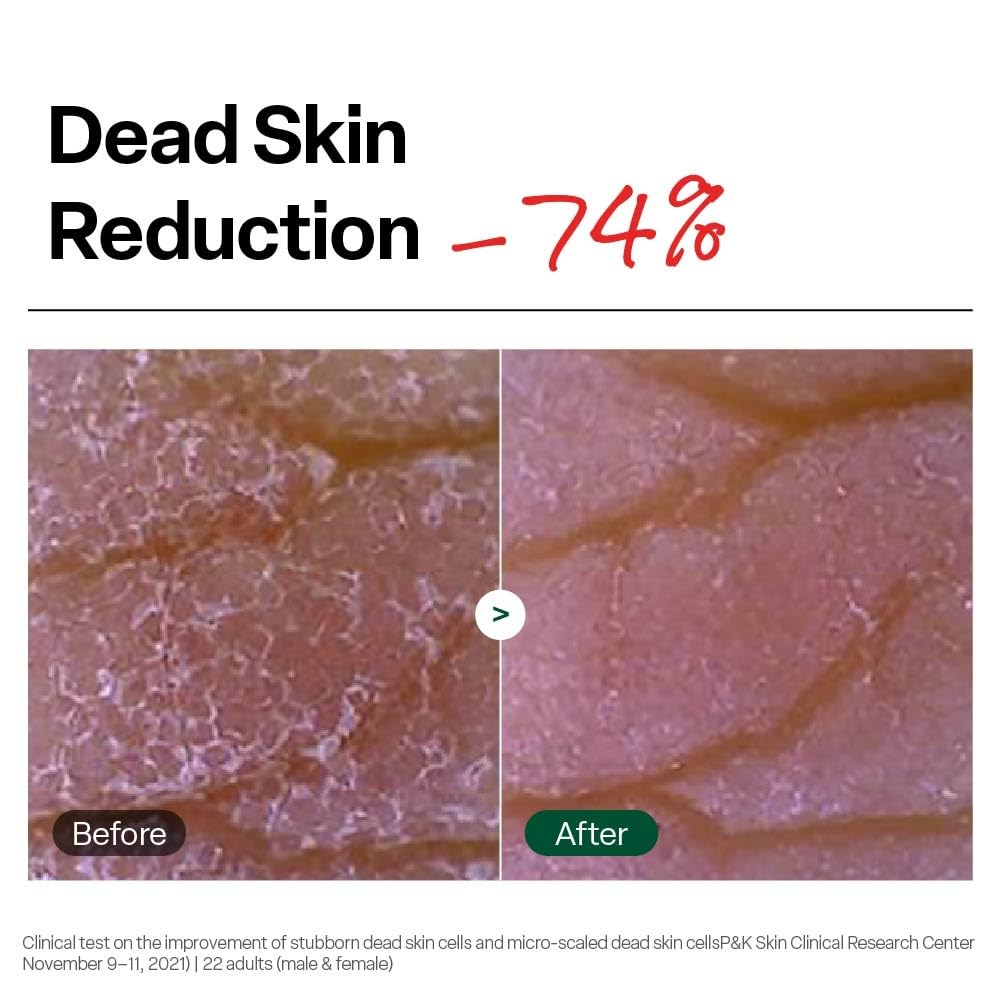 Dr.G Brightening Peeling Gel application on skin
