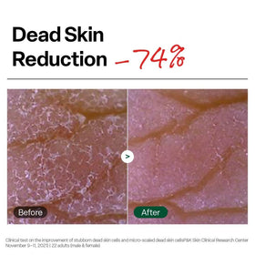 Dr.G Brightening Peeling Gel application on skin