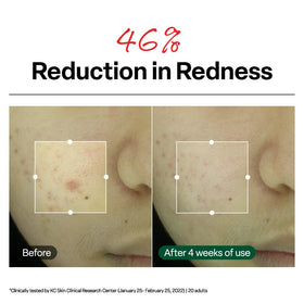Dr.G R.E.D. Blemish Clear Soothing Face Cream with packaging