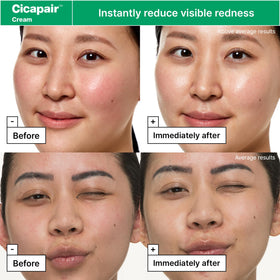 Dr.Jart+ Cicapair Redness Rescue Set on a bathroom counter