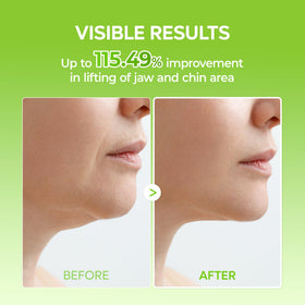Dr.Melaxin CACTOX V-Lifting Mewing Band close-up of fabric