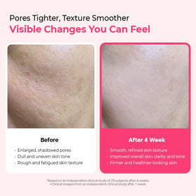 Dr.Melaxin Cyano Pink Spicule Serum bottle close-up showing texture