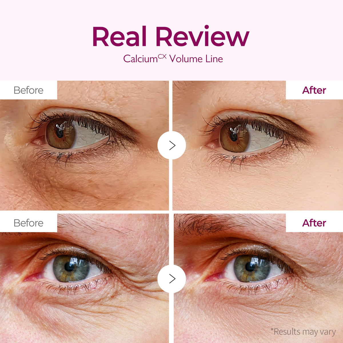 Dr.Melaxin Hydrogel Eye Mask application on skin
