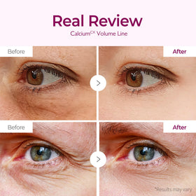 Dr.Melaxin Hydrogel Eye Mask application on skin