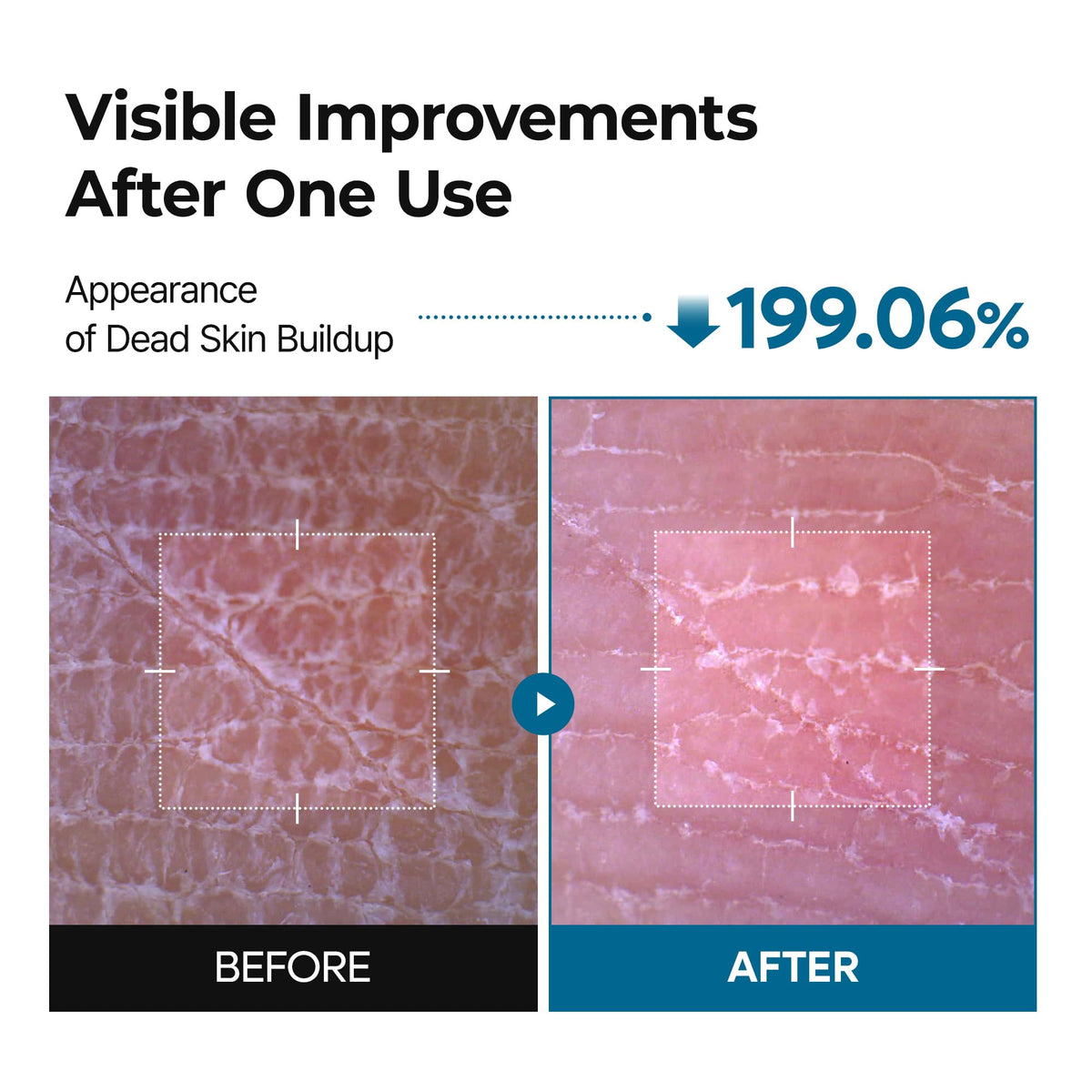Dr.Melaxin Peel Shot Exfoliating Spray 200ml side view