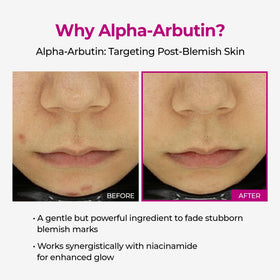 Dr.Melaxin Picotonic Shot Serum texture close-up