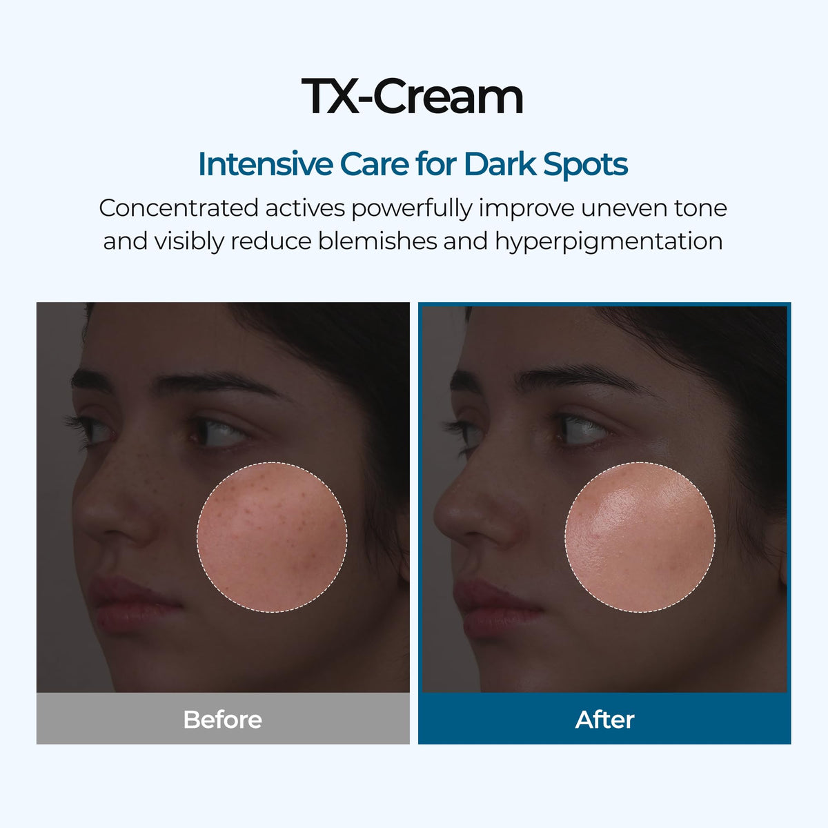 Dr.Melaxin TX Tranexamic Acid Cream 50ml side view