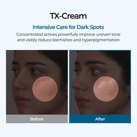 Dr.Melaxin TX Tranexamic Acid Cream 50ml side view