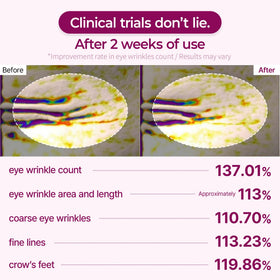 Dr.Melaxin Under Eye Patches packaging details