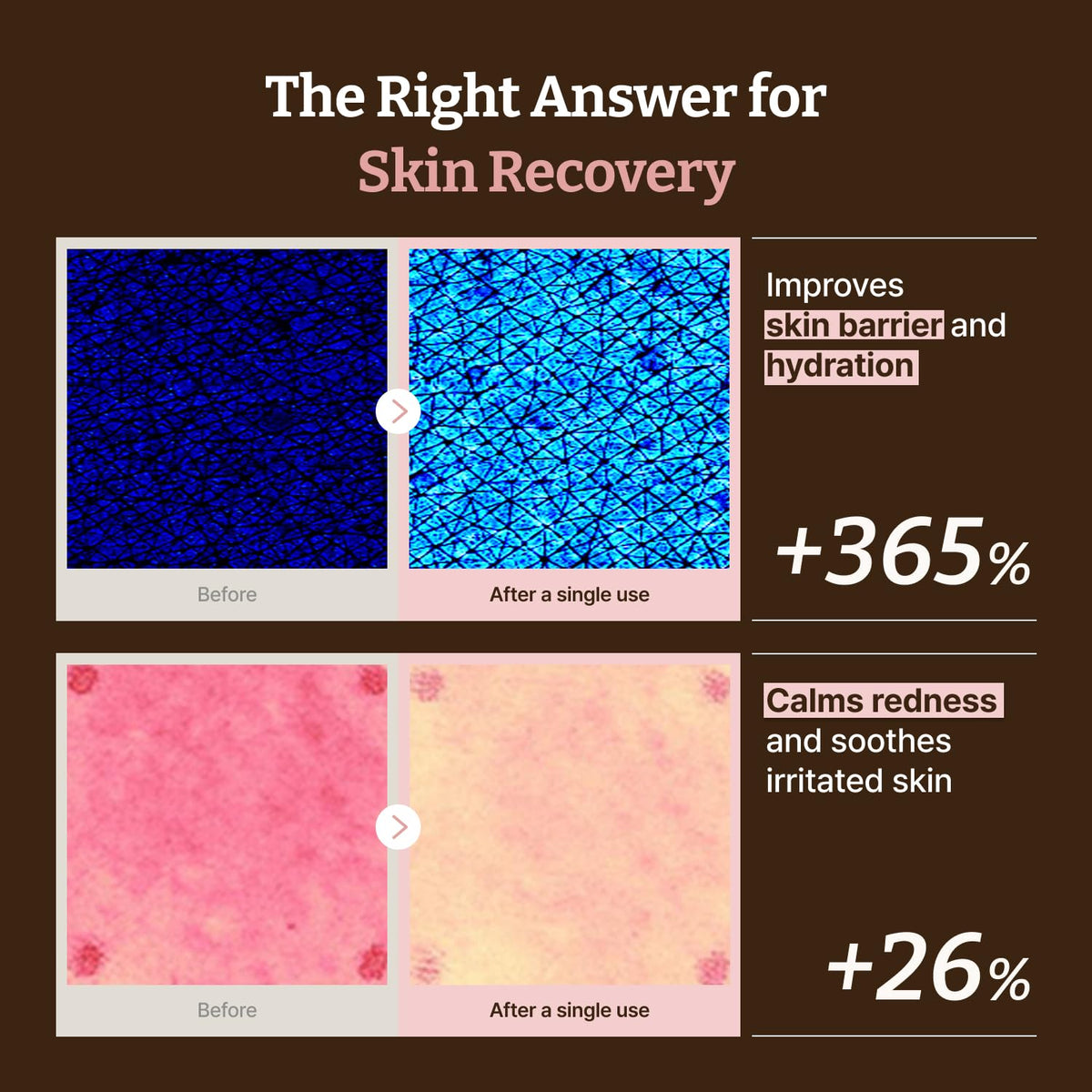 Dr.Reju-All Advanced PDRN Rejuvenating Cream application on skin