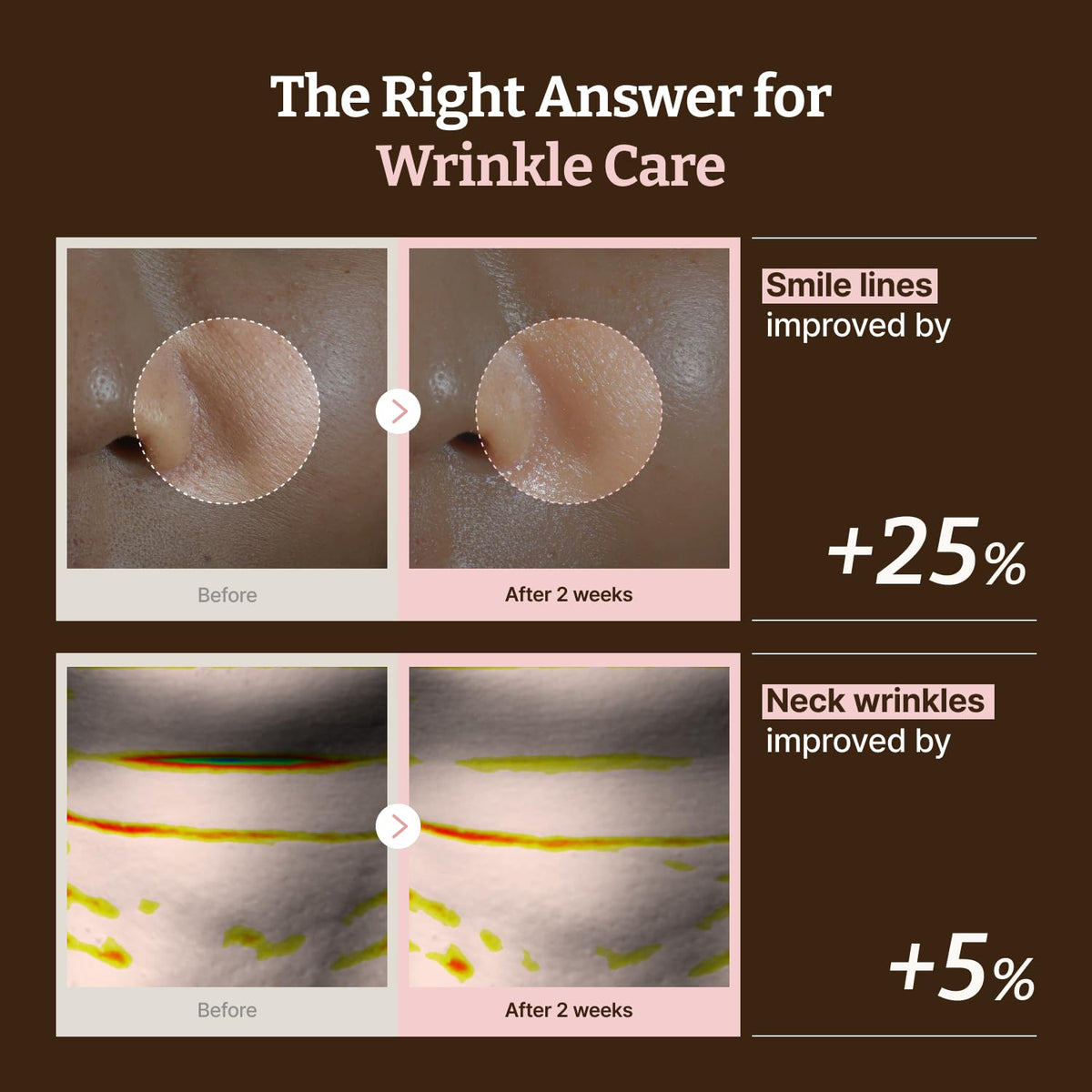 Dr.Reju-All Advanced PDRN Rejuvenating Mask neck sheet close-up