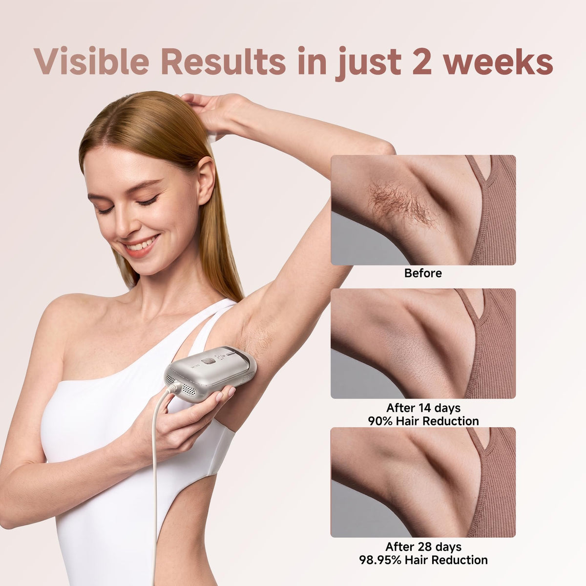 Dreame Nova IPL Hair Removal Device side view with window