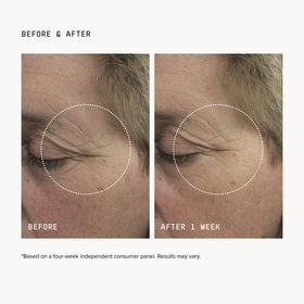 DRMTLGY Brightening Eye Masks application on model
