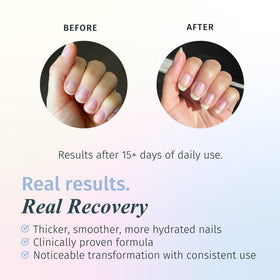 duri Rejuvacote 1 Nail Strengthener bottle side view