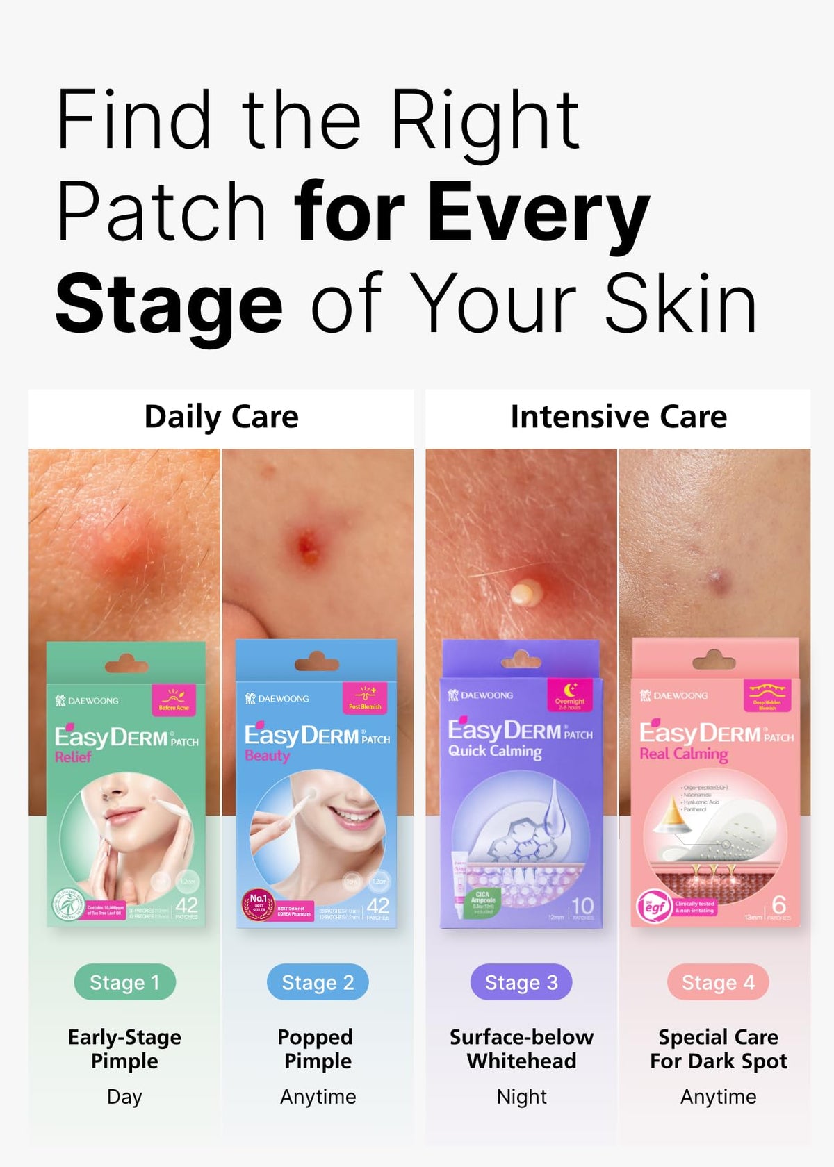 DWEasyDerm Pimple Patch on skin for blemish care