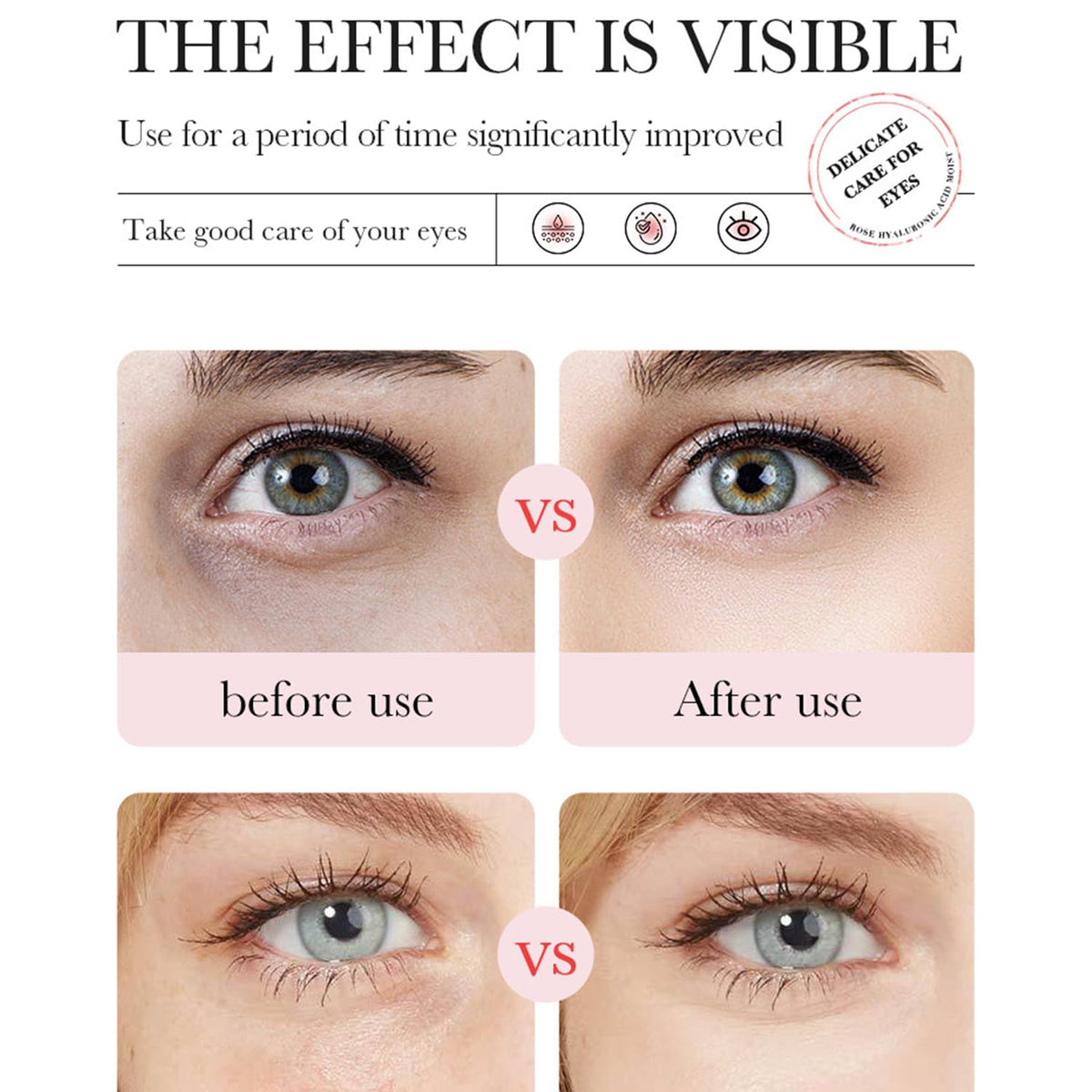 Eakroo Rose Eye Mask applied on under eyes