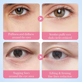 Eakroo Under Eye Patches gel patch in use on a relaxing background