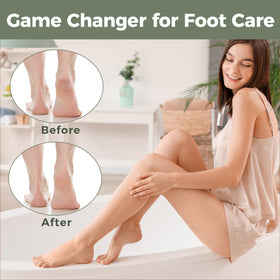 Easkep Foot File alongside other foot care tools