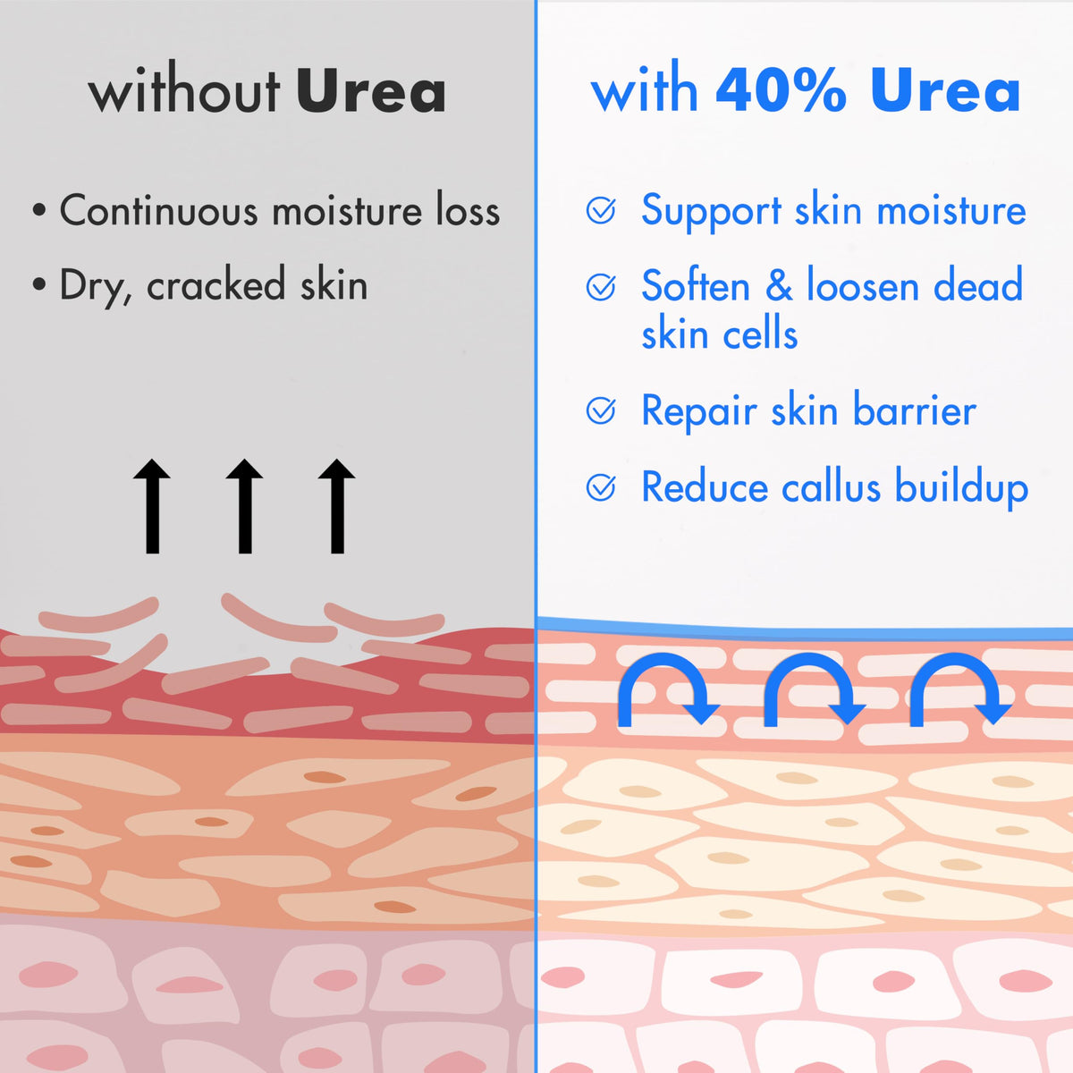 Ebanel Urea Cream 40% texture close-up