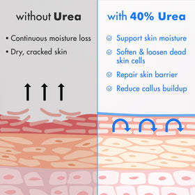 Ebanel Urea Cream 40% texture close-up