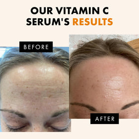 Eclat Skincare Vitamin C Serum 1 Fl Oz on a bathroom shelf