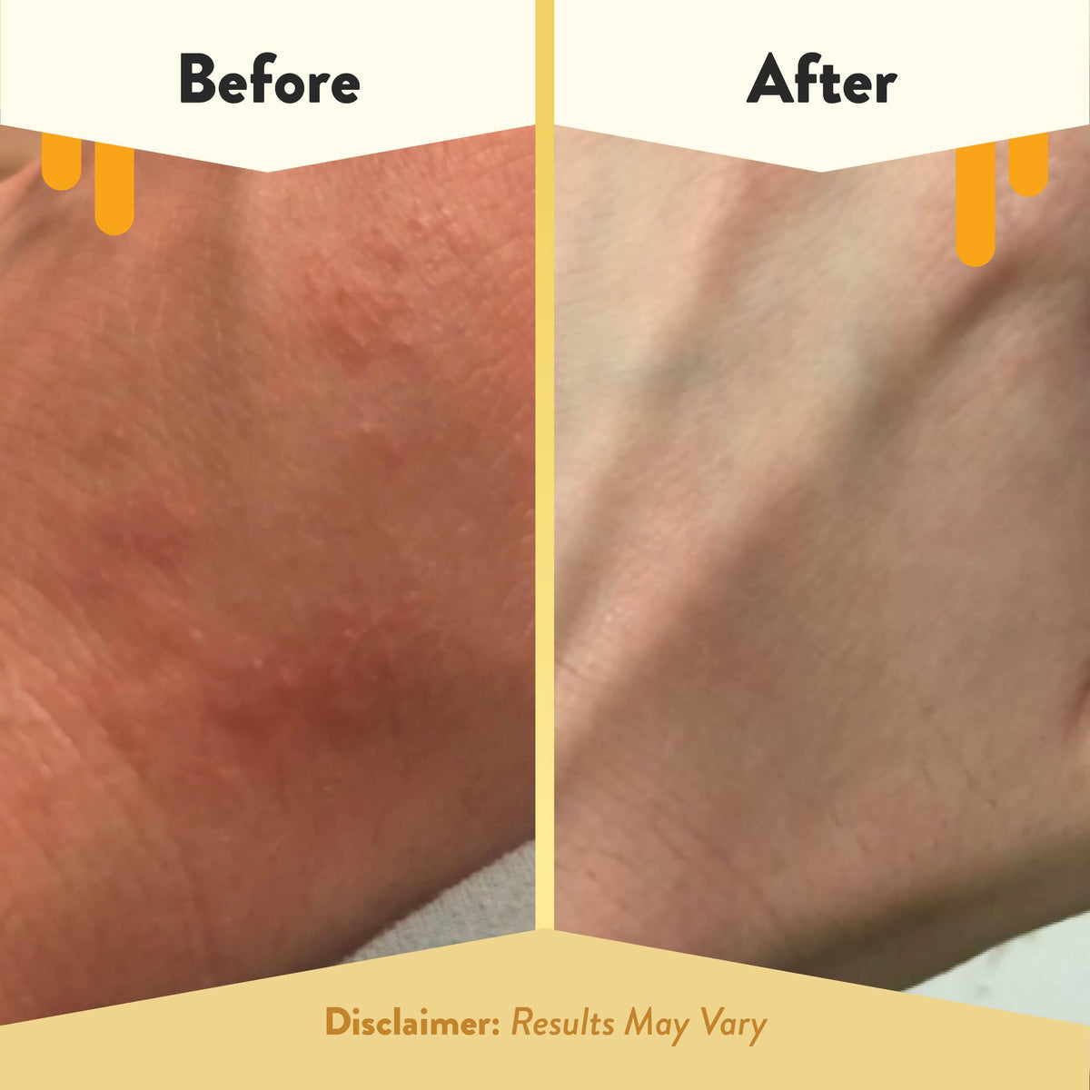 ECZEMA HONEY Oatmeal Body Lotion application on skin