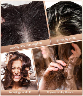 EHBELIF Dandruff Comb displayed with hair care products