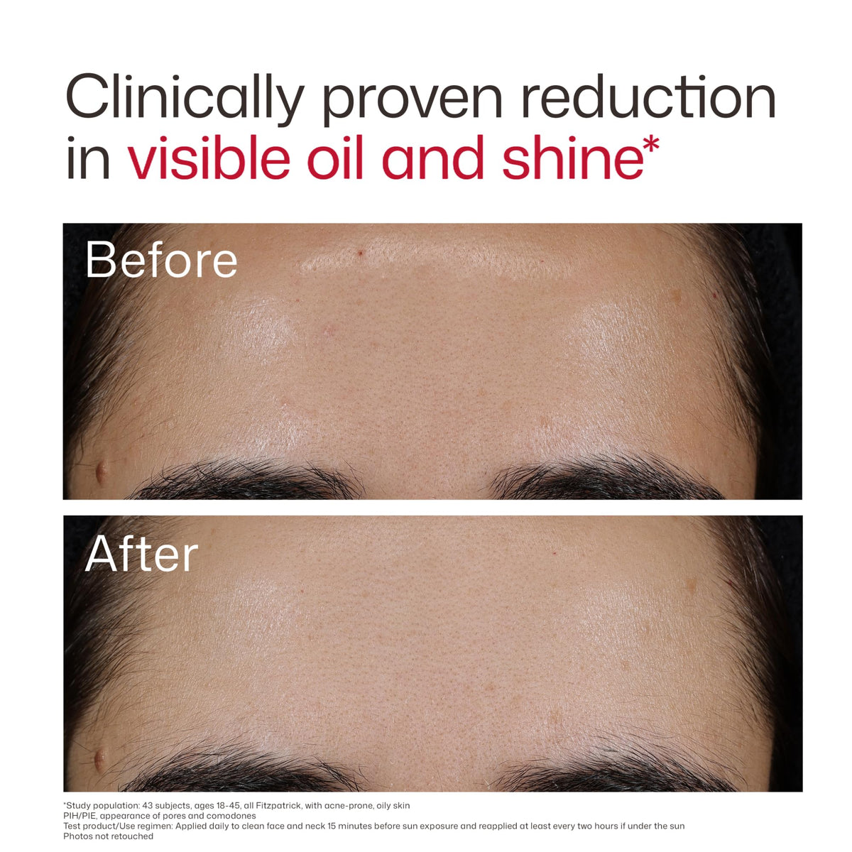 EltaMD UV Clear Blemish-Prone SPF 50 ingredients list