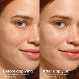 EltaMD UV Clear Blemish-Prone SPF 50 texture on skin