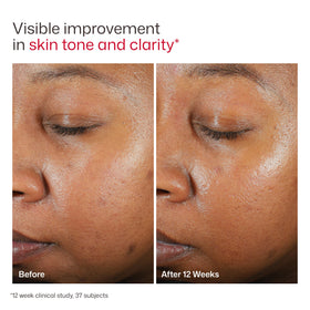EltaMD UV Clear Face Sunscreen SPF 46 packaging details