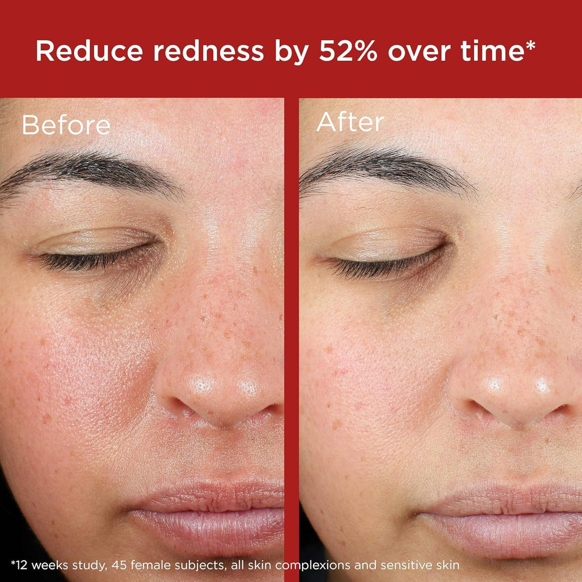 EltaMD UV Skin Recovery Face Sunscreen SPF 50 green tinted texture close-up