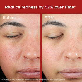EltaMD UV Skin Recovery Face Sunscreen SPF 50 green tinted texture close-up