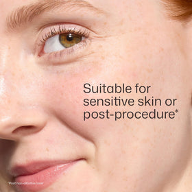EltaMD UV Skin Recovery sunscreen in a travel bag