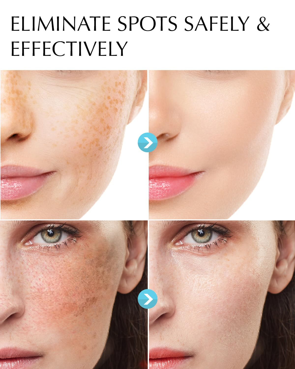 EnaSkin Dark Spot Corrector Cream packaging side view