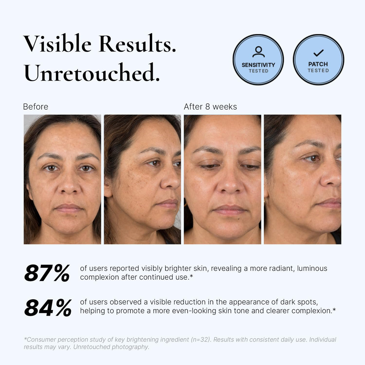 EnaSkin Dark Spot Corrector Serum application on skin