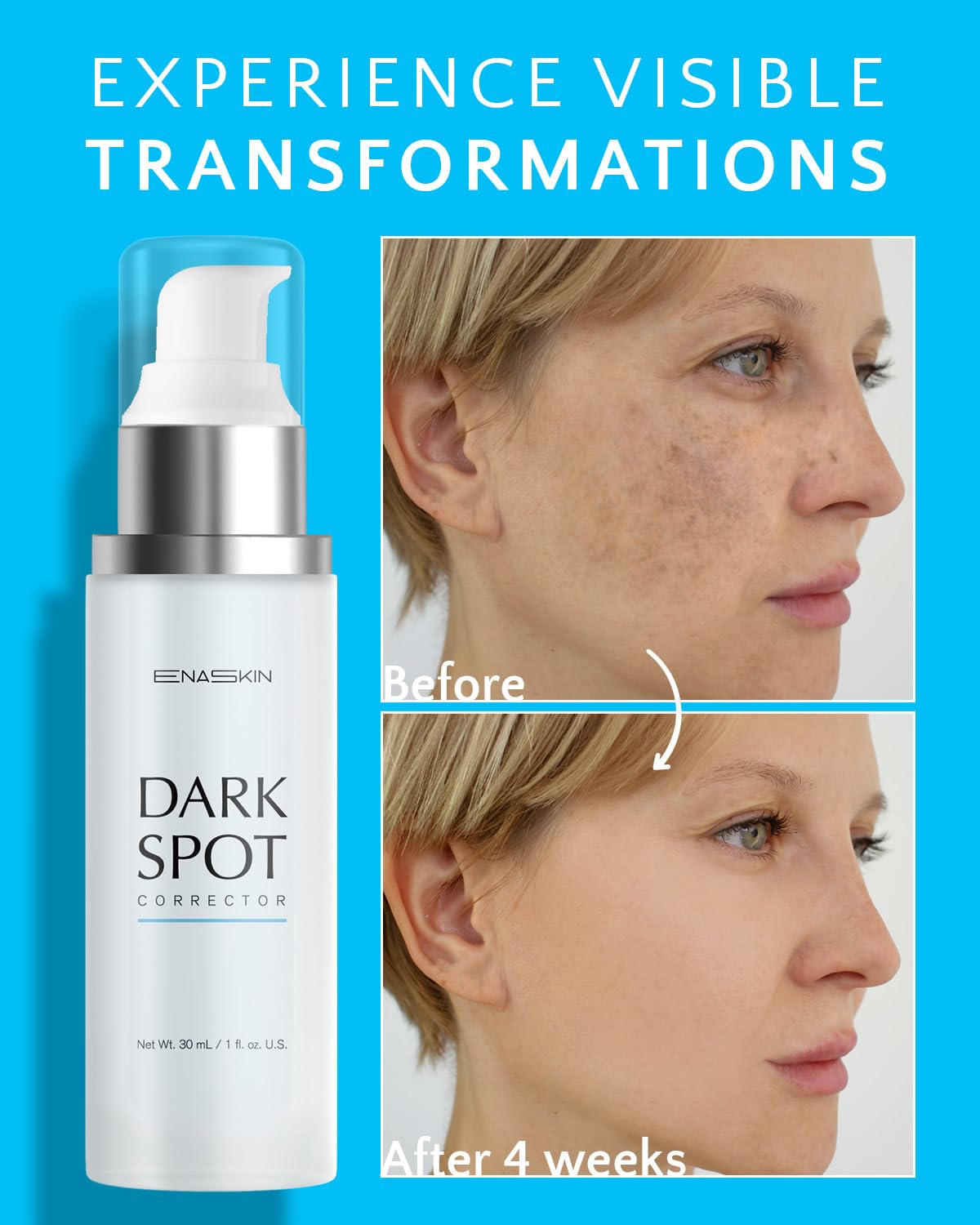 EnaSkin Dark Spot Remover Serum packaging side view