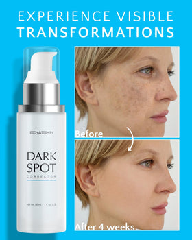 EnaSkin Dark Spot Remover Serum packaging side view