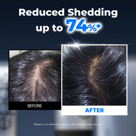 EPAIS Hair Serum 150ml side view showing comb applicator