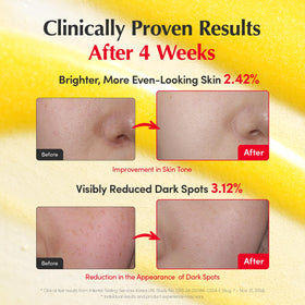 EQQUALBERRY Vitamin Serum application on skin