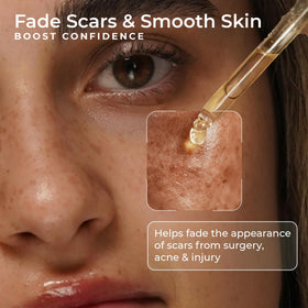 Everyday Beauty Organic Vitamin E Oil for Scars application on skin